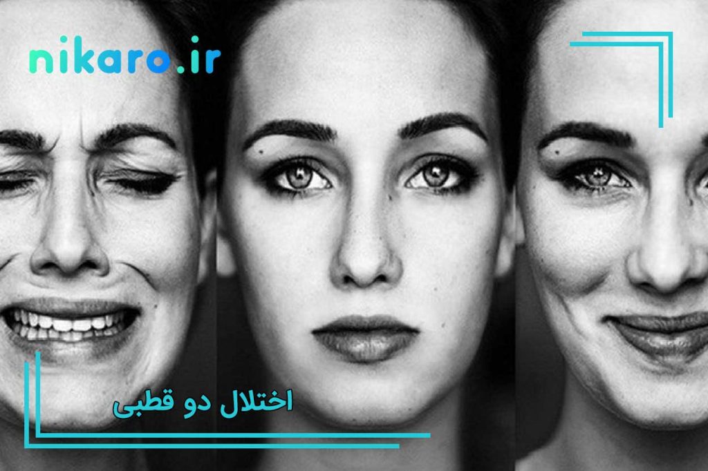 اختلال دو قطبی